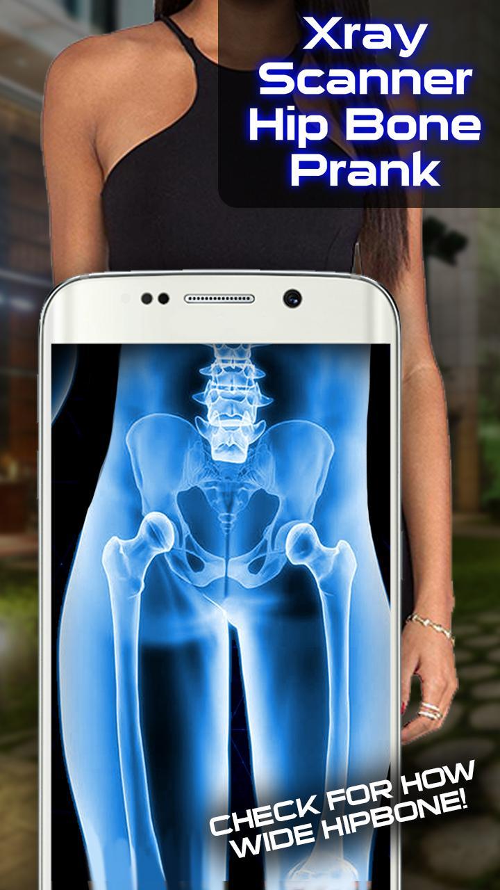 Xray Scanner Hip Bone Prank