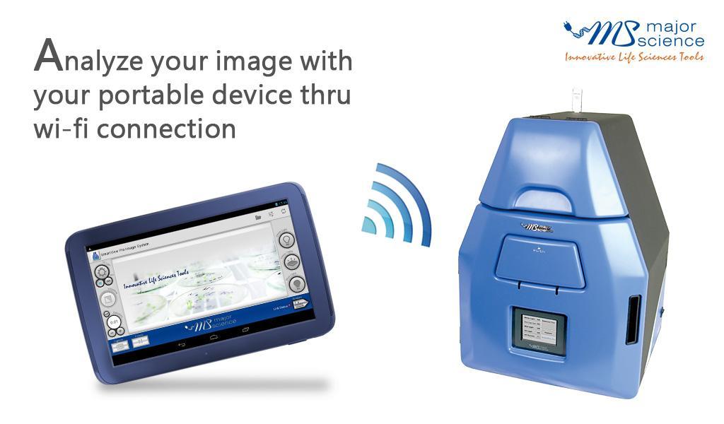 SmartView Pro Imager System