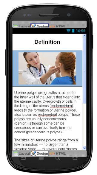 Uterine Fibroids Information