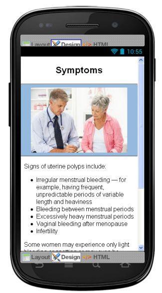 Uterine Fibroids Information