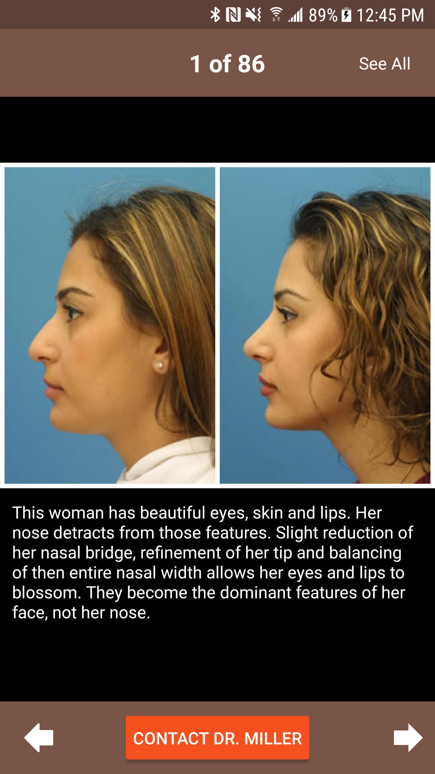 Plastic Surgery w/ Dr. Miller