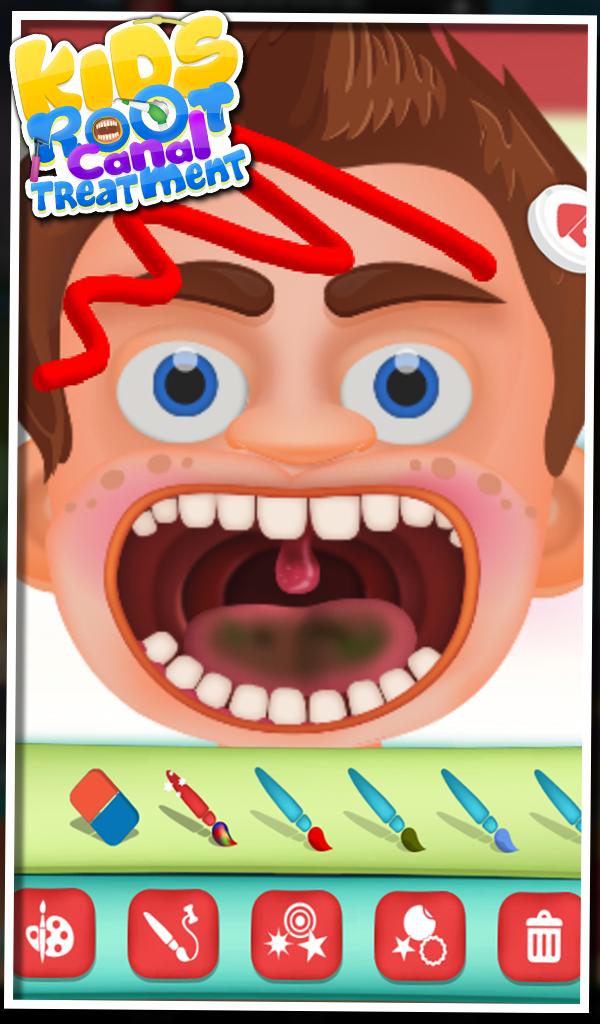 Root Canal Treatment