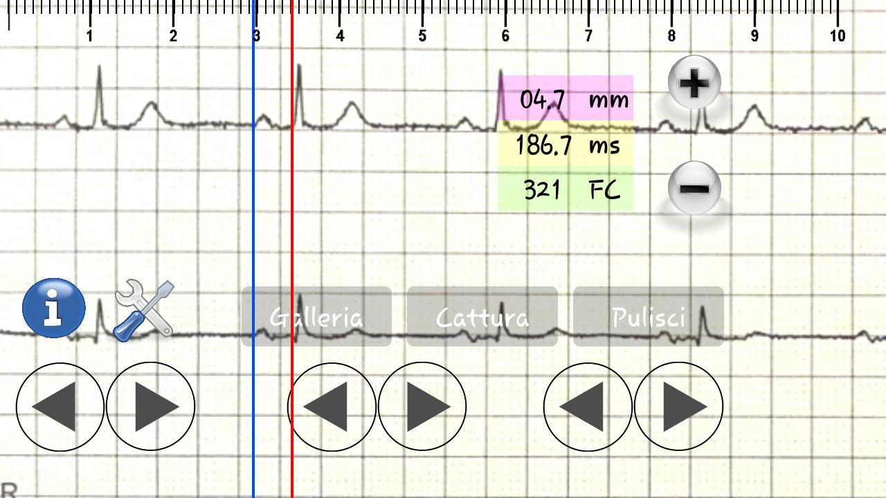 ECG Caliper Demo