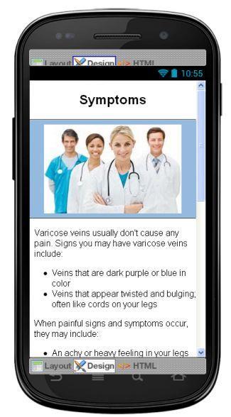 Varicose Veins Information