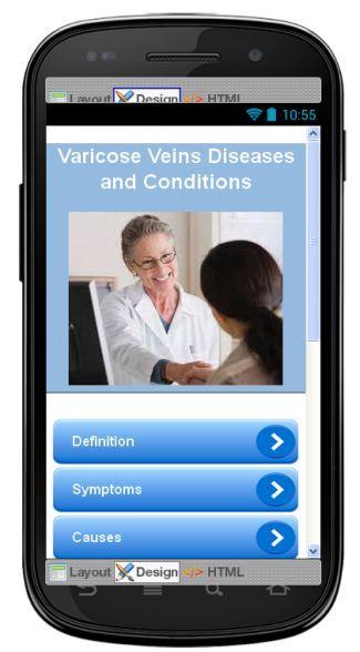 Varicose Veins Information