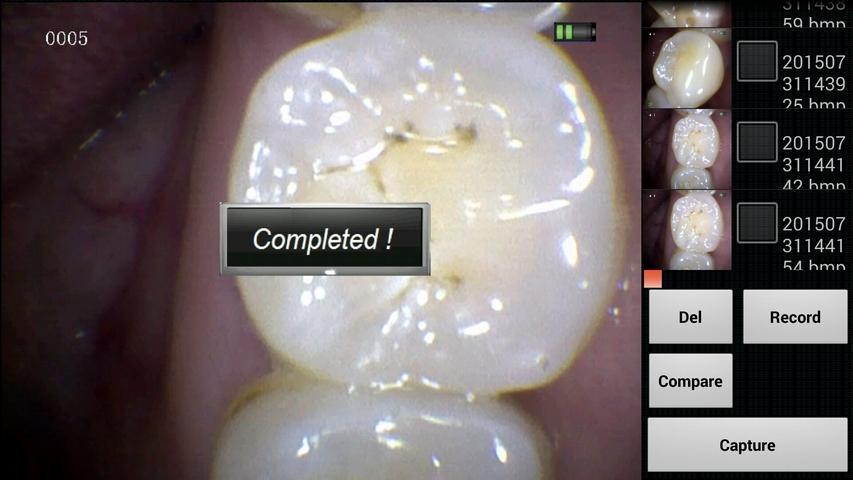 Premium Plus Intra Oral Camera