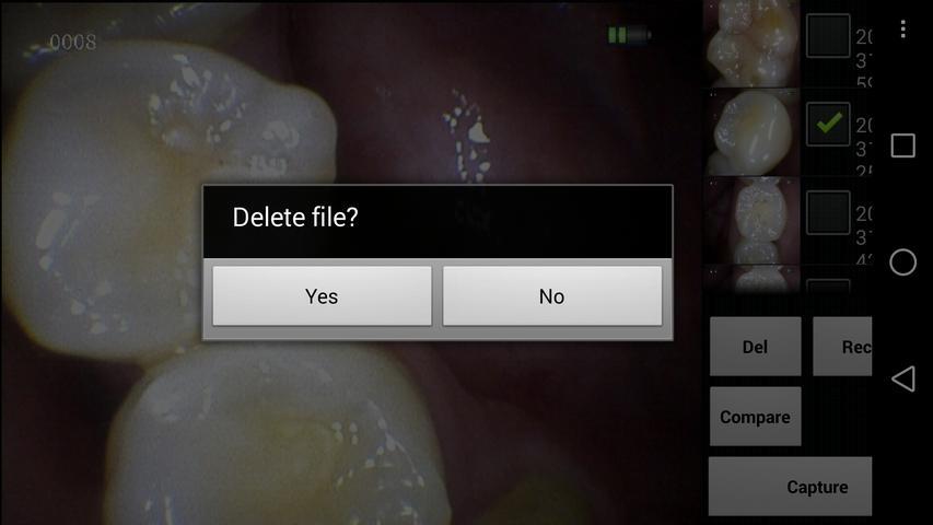 Premium Plus Intra Oral Camera