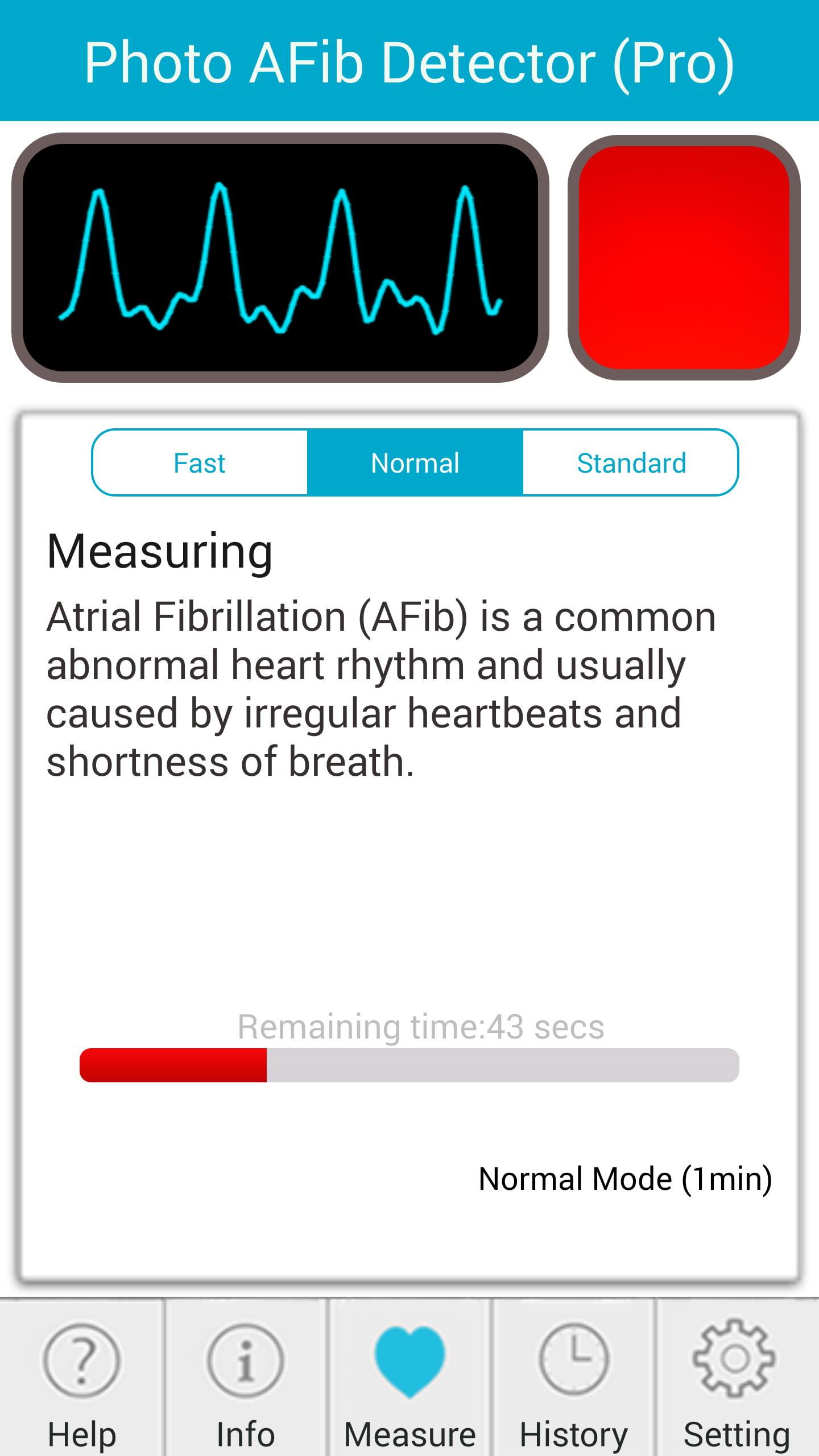 Photo AFib Detector