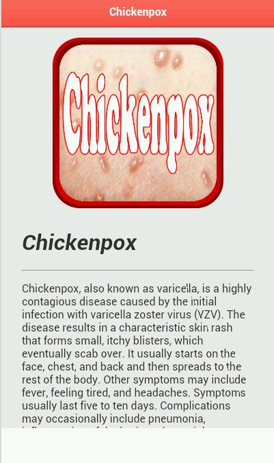 Chickenpox Disease