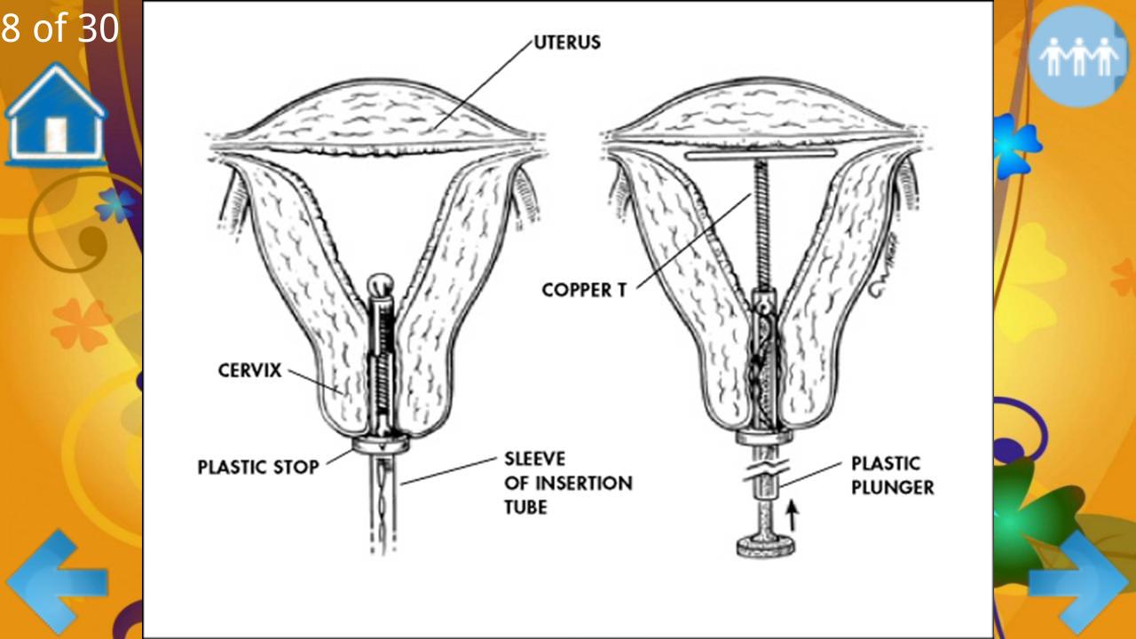 Methods For Birth Control
