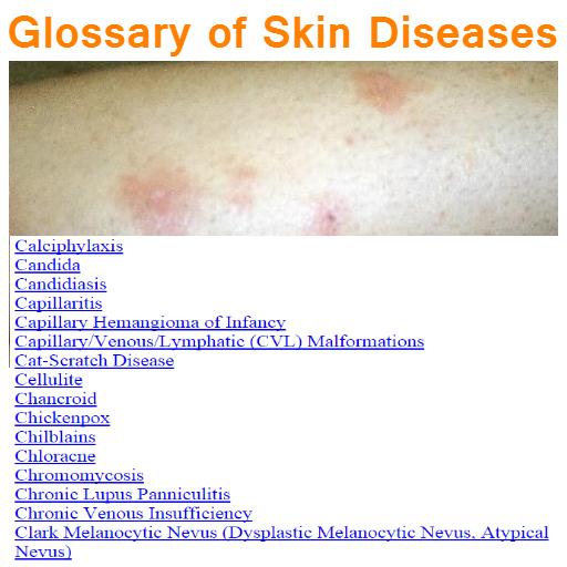 Skin Disease Glossary