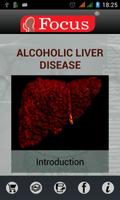 Alcoholic Liver Disease (ALD)