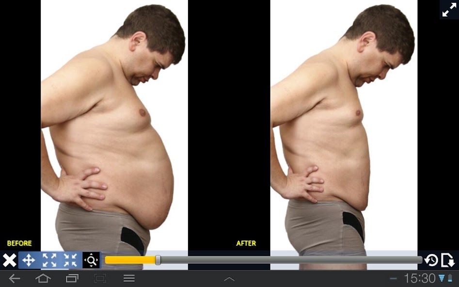 Plastic Surgery Simulator Lite